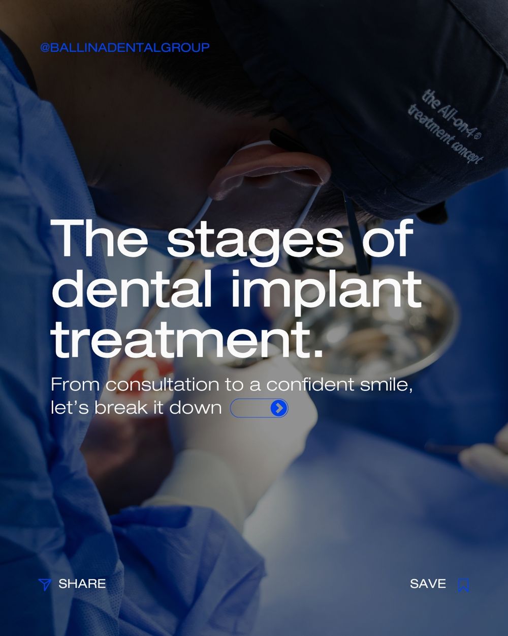 Implant carousel