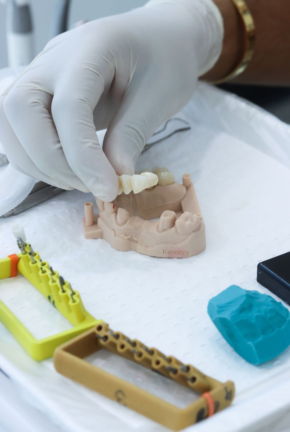 Lab technician shaping a crown