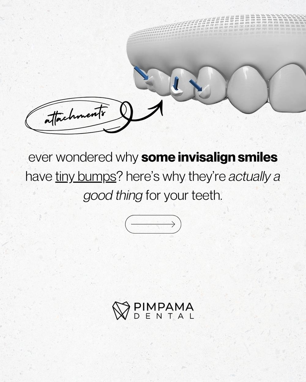 Invisalign carousel