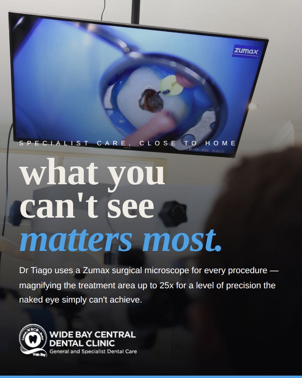 Microscope dentistry post